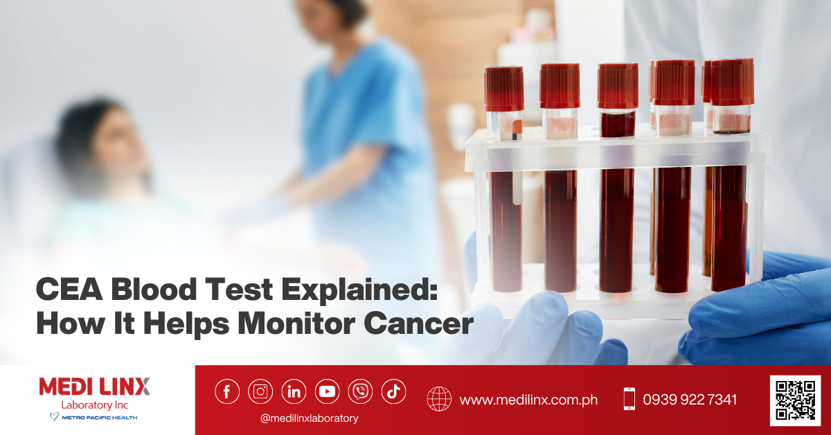 carcinoembryonic ag test
