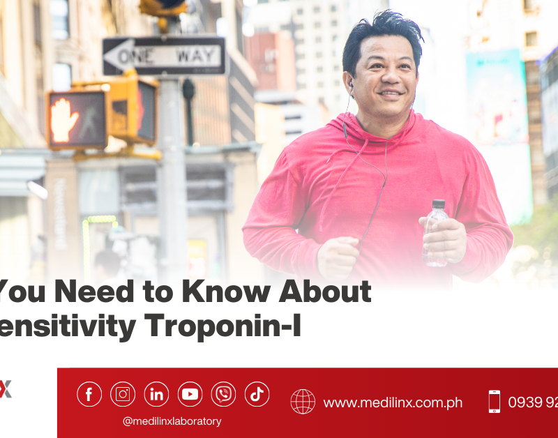 high sensitivity troponin i