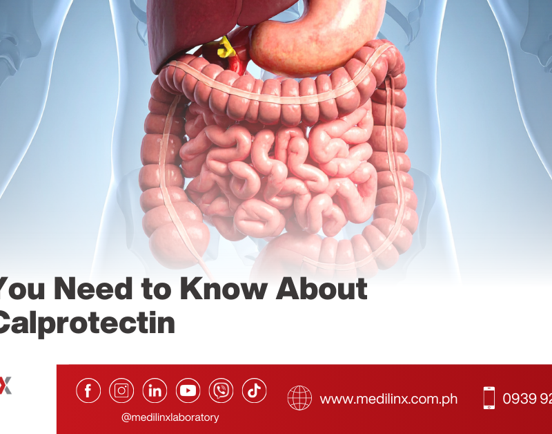 Fecal Calprotectin Test