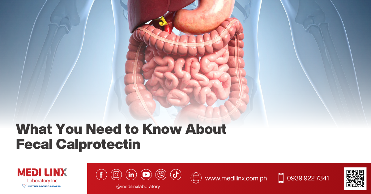 Fecal Calprotectin Test