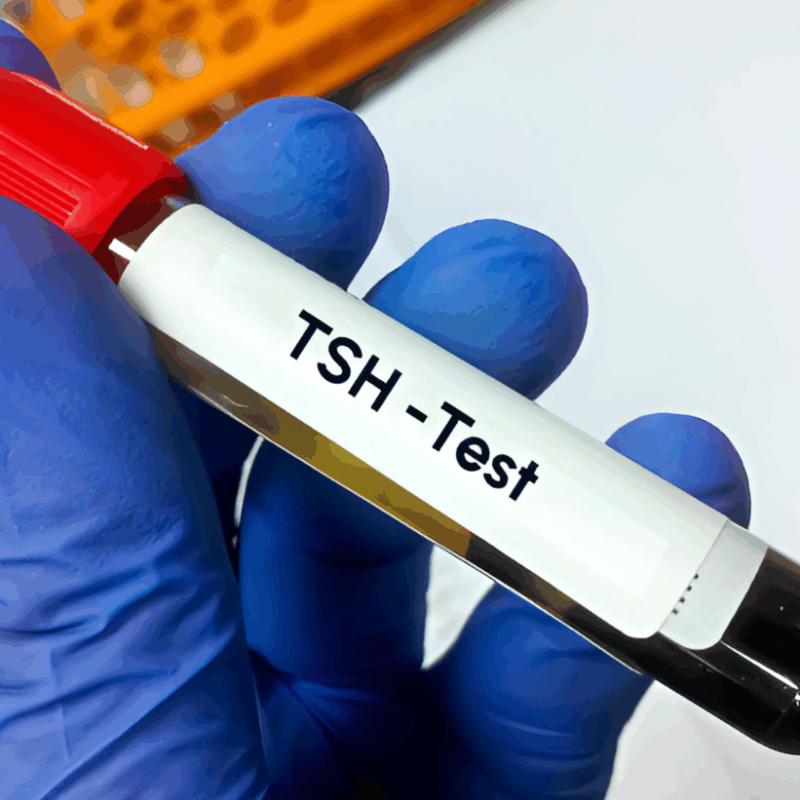tsh