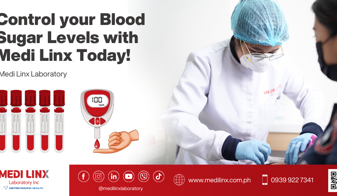 FBS Blood Sugar Laboratory Test