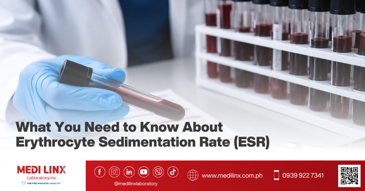 Erythrocyte Sedimentation Rate