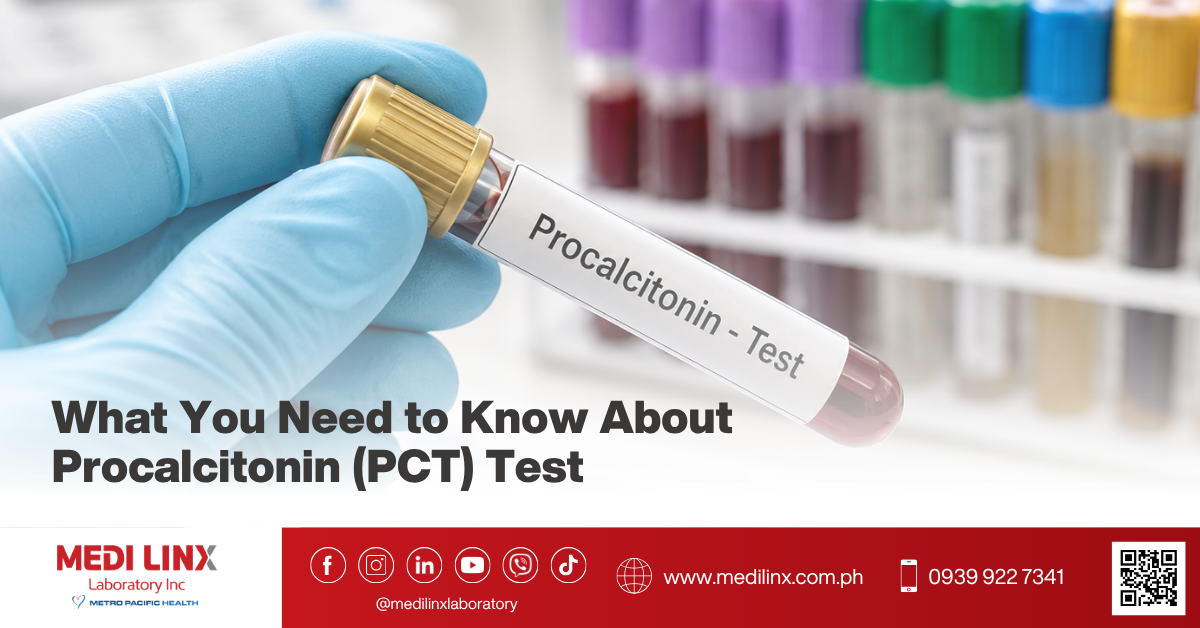 Procalcitonin (PCT)