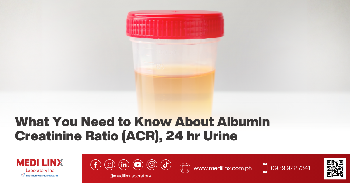 albumin creatinine ratio