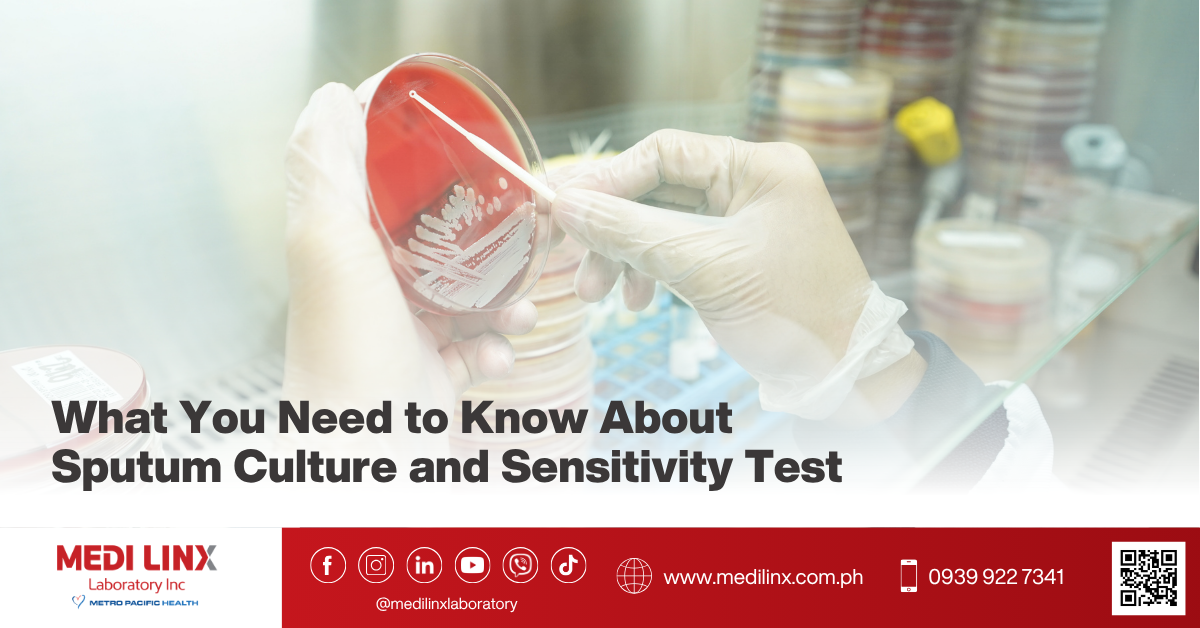 Sputum Culture and Sensitivity