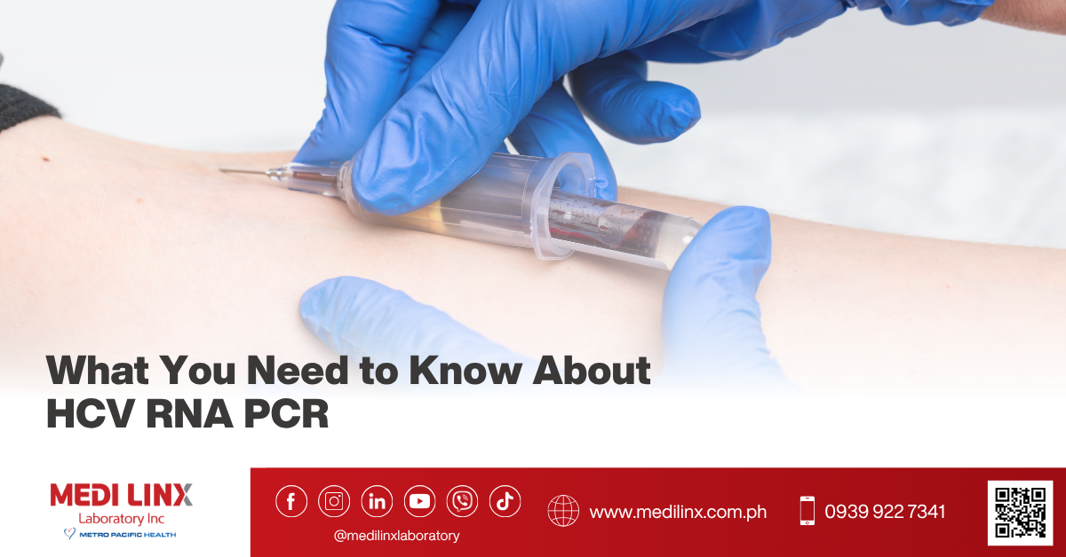 HCV RNA PCR (Hepatitis C Virus)