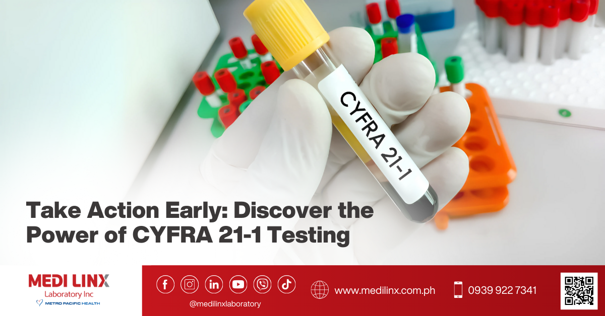 cyfra 21 1 test
