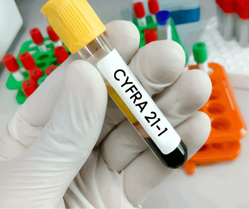 cyfra 21 1