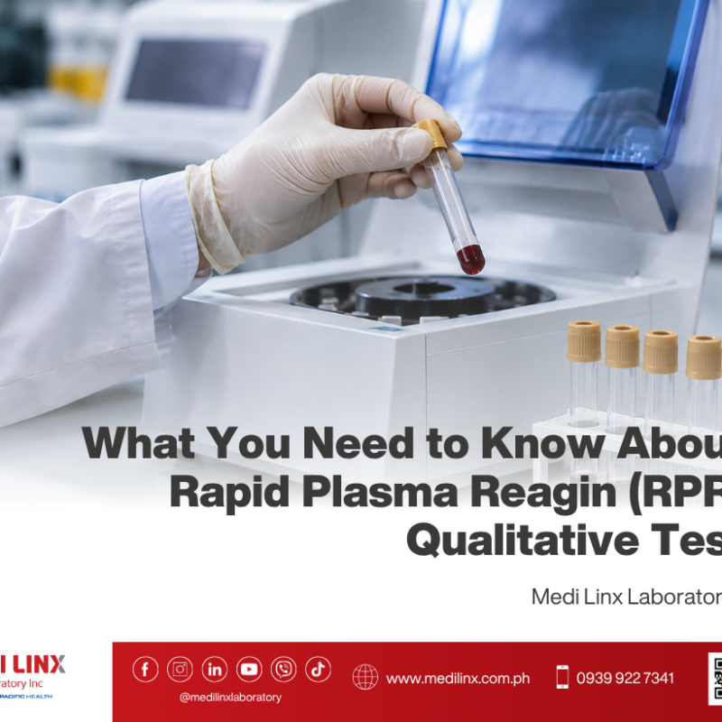 Rapid Plasma Reagin (RPR) Test