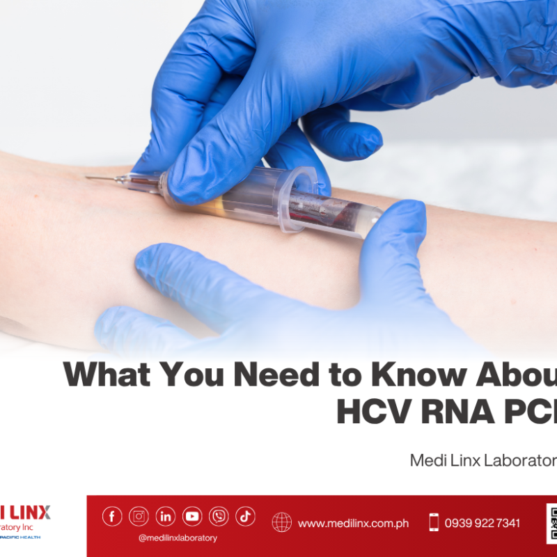 HCV RNA PCR