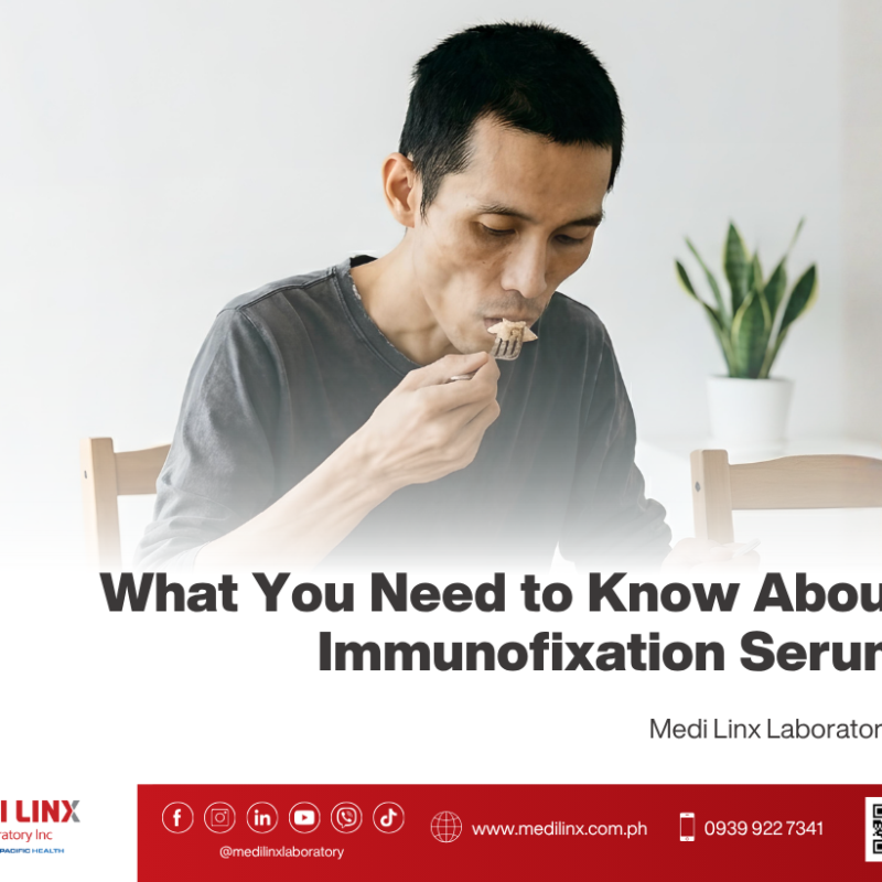 Immunofixation Serum Test