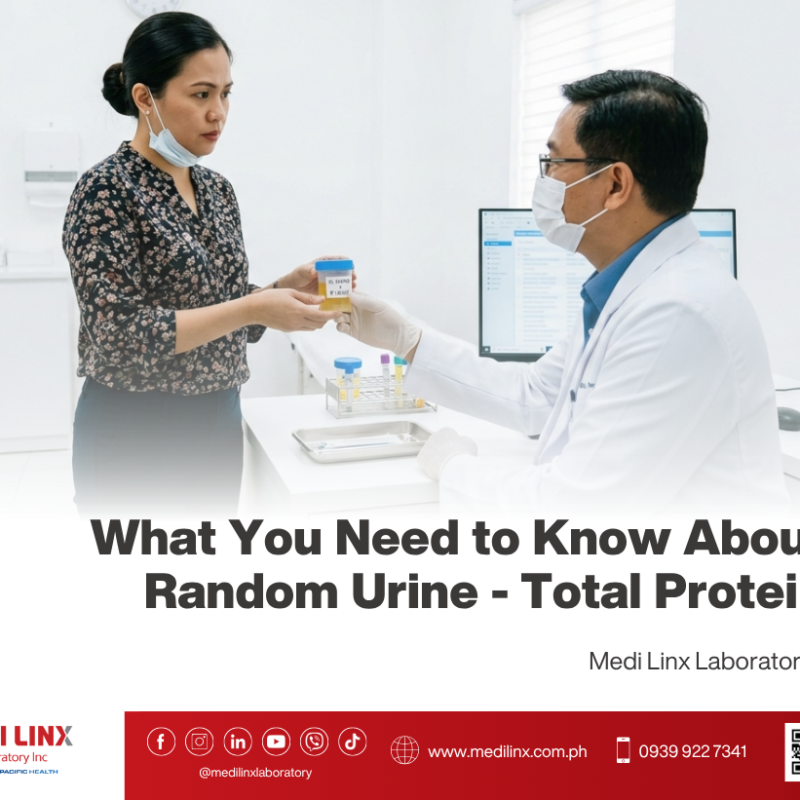 Random Urine - Total Protein