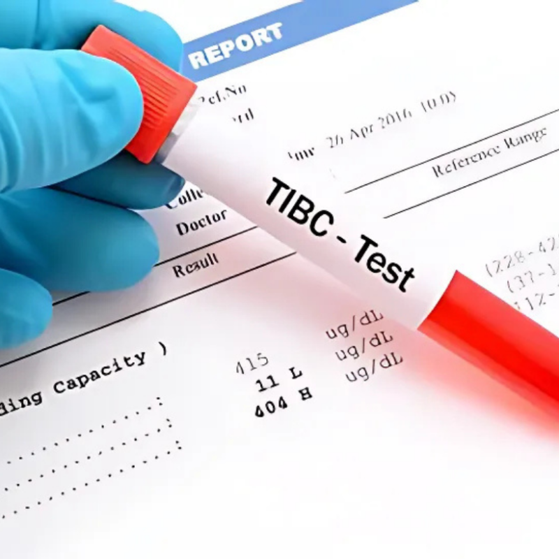 total iron binding capacity