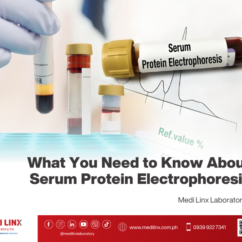 Serum Protein Electrophoresis