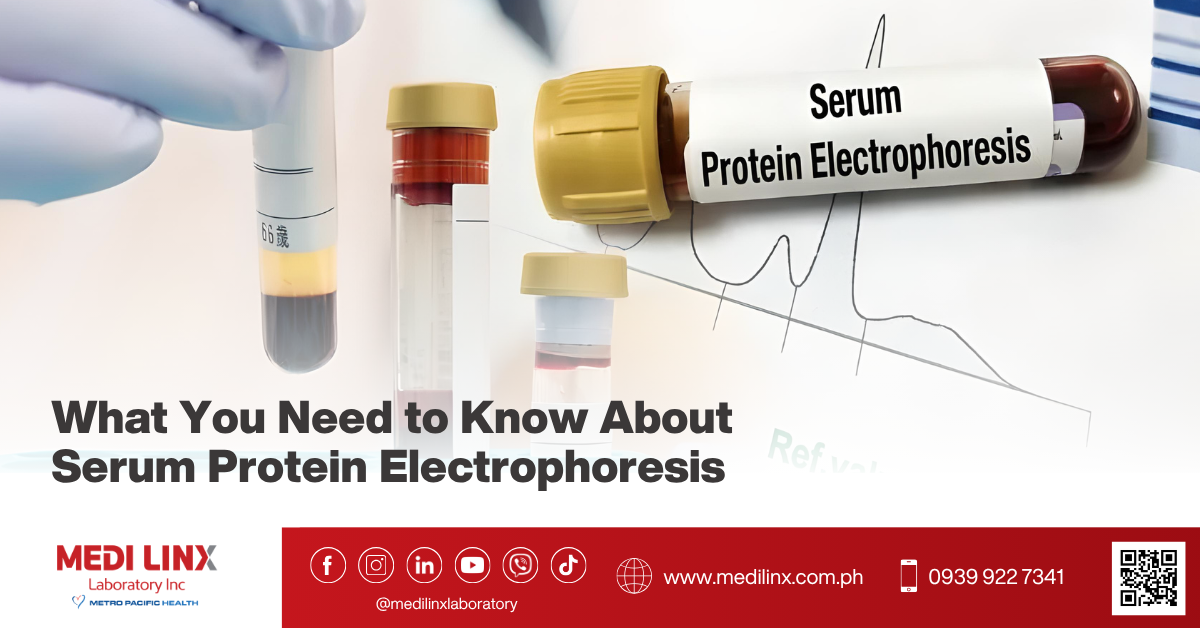 Serum Protein Electrophoresis