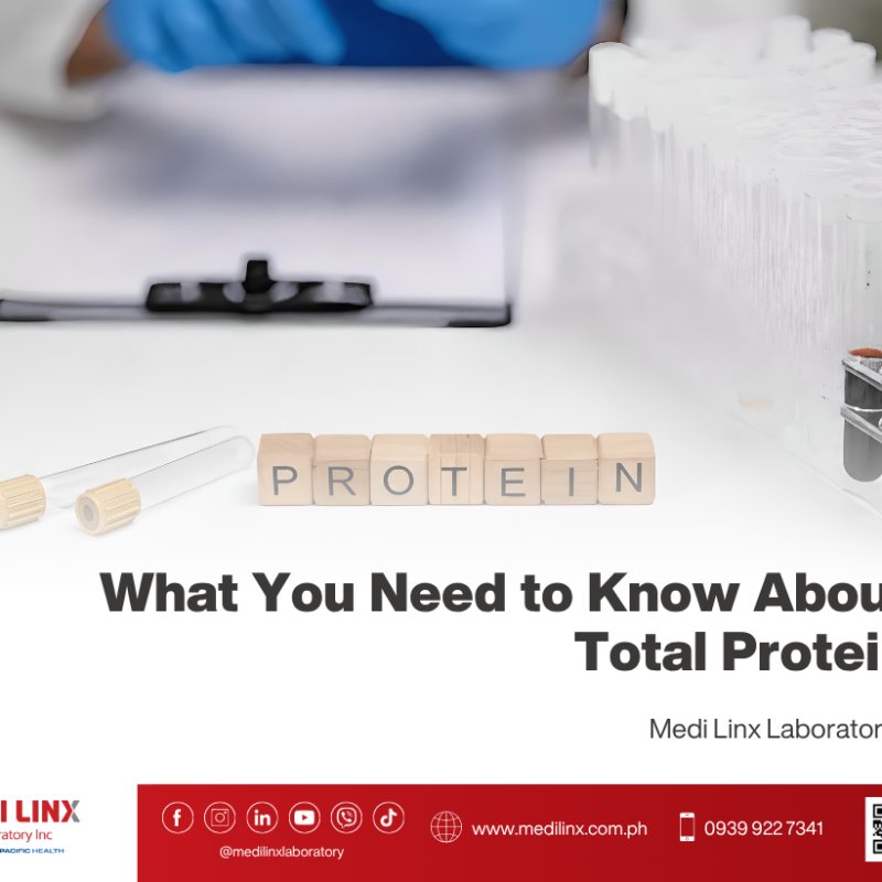 Total Protein Test