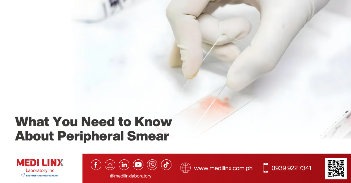peripheral smear