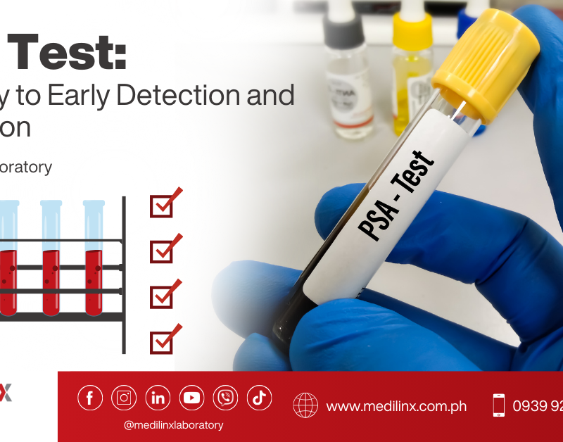 PSA Prostate Specific Antigen test