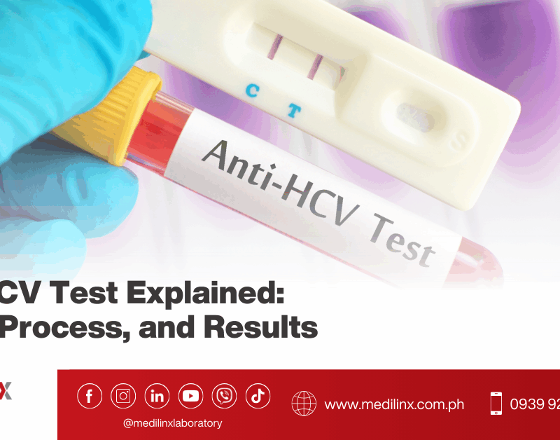 Anti-HCV Test