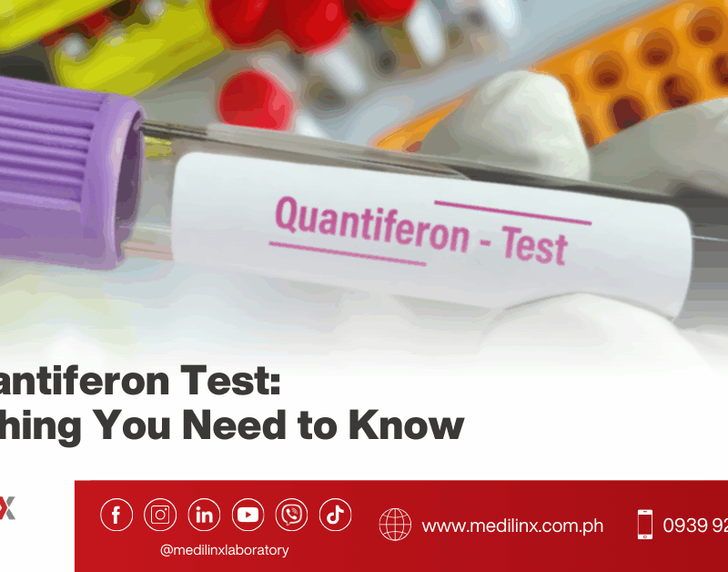 TB Quantiferon