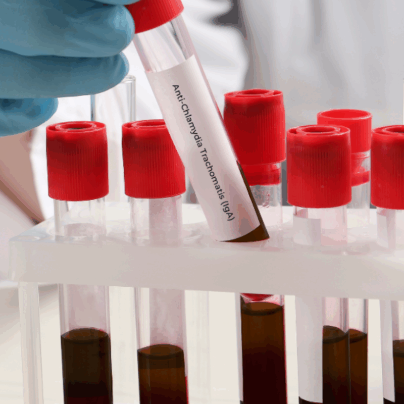 antichlamydia