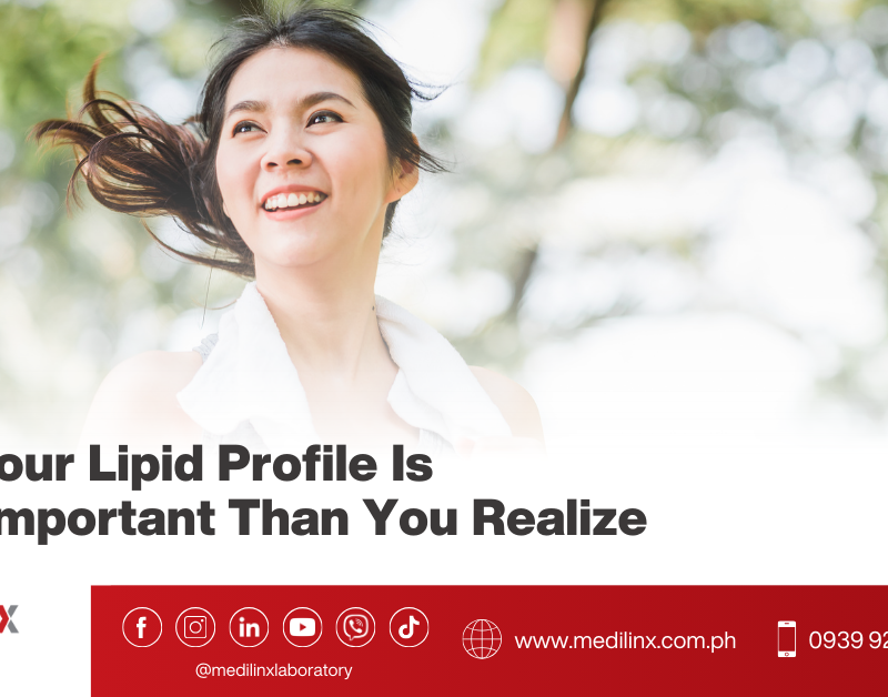 lipid profile hdl ldl tg