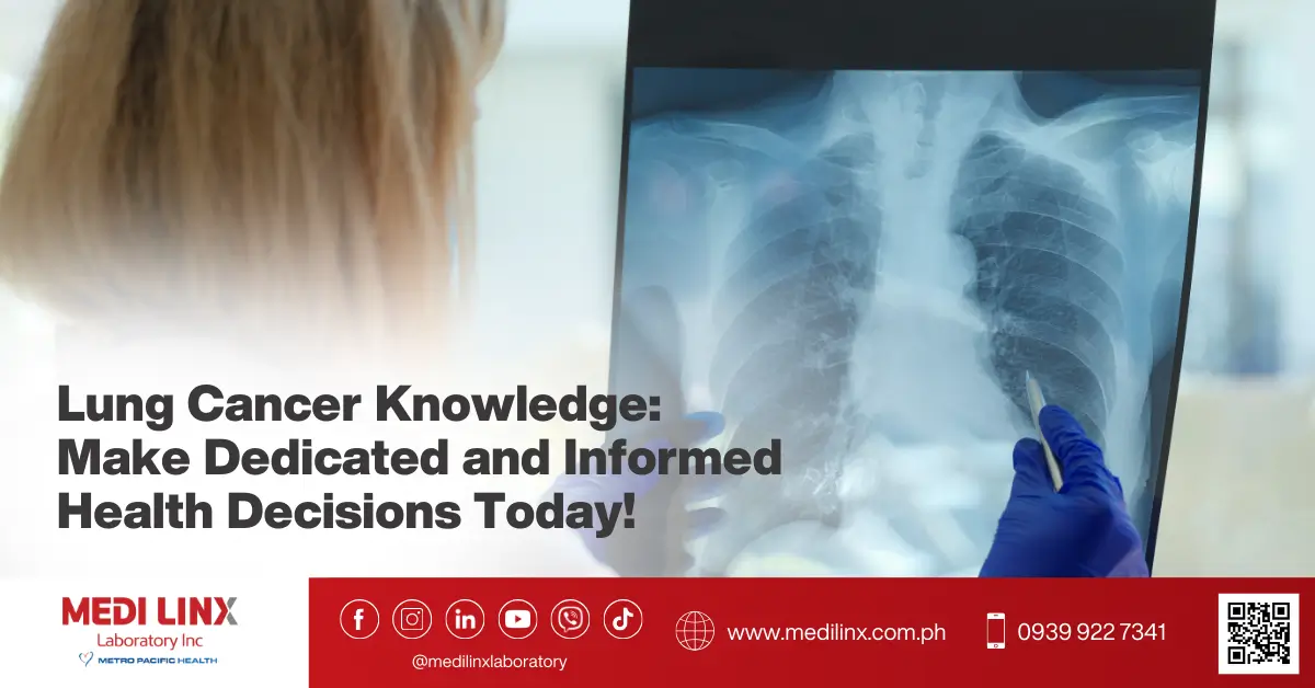 lung cancer